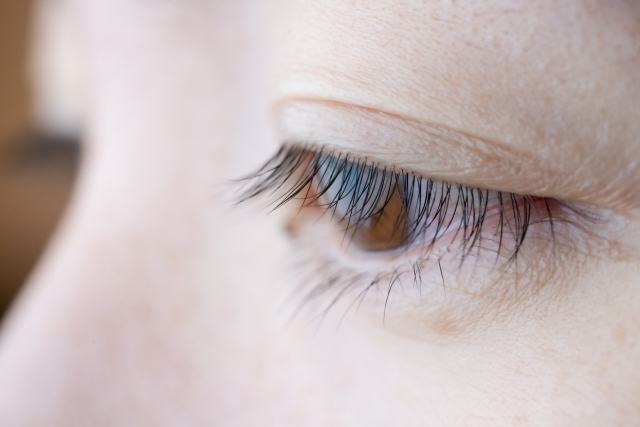 整形手術をした女性の目元