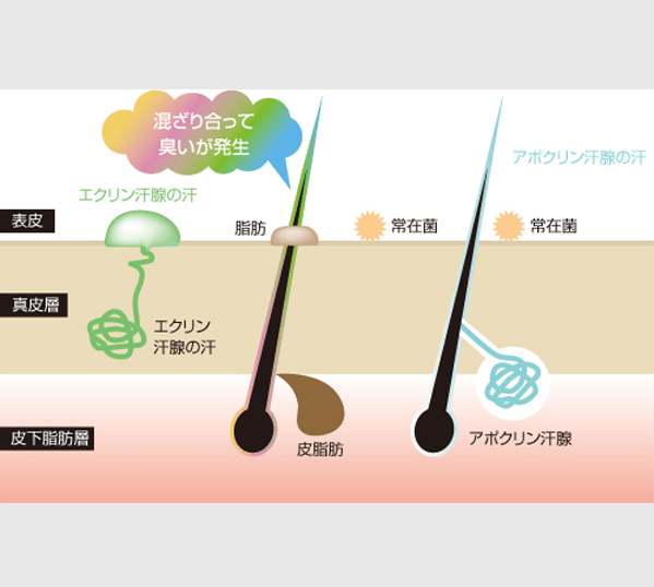 わきがのメカニズム