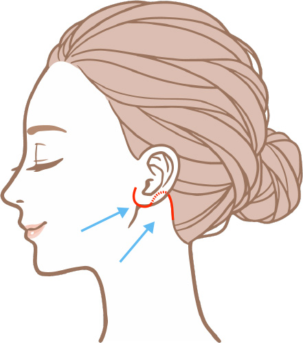 ネック(首)リフト