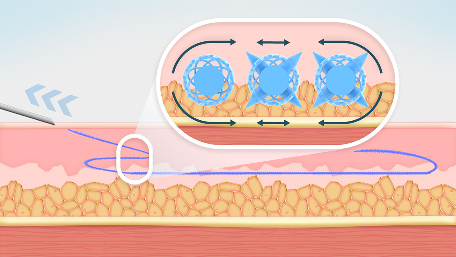⑤さらに折り返し、テスリフトを平行・3重に配置することで、より高い固定強度を保ちます。