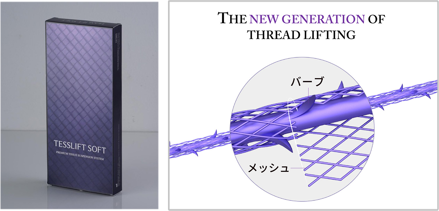 テスリフト(TESSリフト)