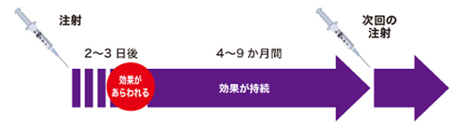 ボツリヌストキシン注射の制汗効果